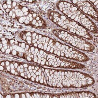 Immunohistochemistry: WDR55 Antibody [NBP2-30625]