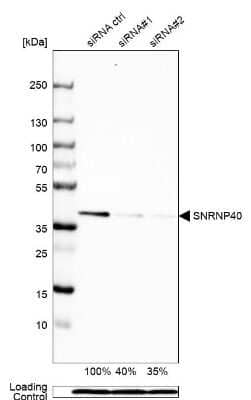 Western Blot: WDR57 Antibody [NBP1-92585]