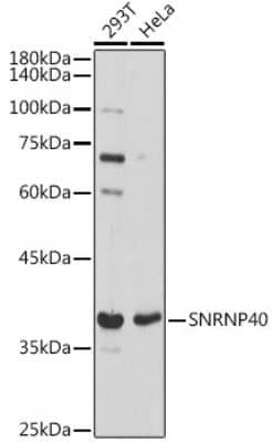 Western Blot: WDR57 AntibodyAzide and BSA Free [NBP3-15611]