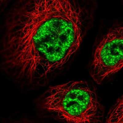 Immunocytochemistry/ Immunofluorescence: WDR58 Antibody [NBP2-31390]