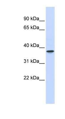 Western Blot: WDR58 Antibody [NBP1-56356]