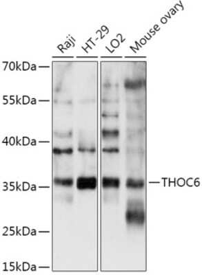 Western Blot: WDR58 AntibodyAzide and BSA Free [NBP2-94392]