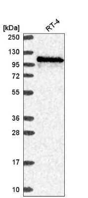 Western Blot: WDR59 Antibody [NBP2-57508]