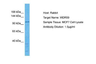 Western Blot: WDR59 Antibody [NBP2-86377]