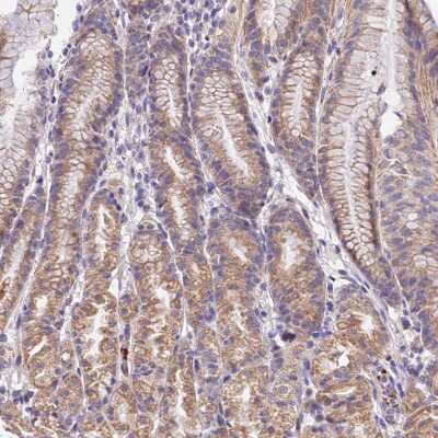 Immunohistochemistry-Paraffin: WDR5B Antibody [NBP1-92587]