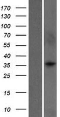 Western Blot: WDR5B Overexpression Lysate [NBP2-06728]