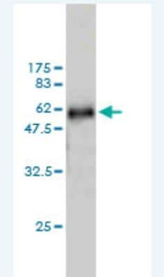 Western Blot: WDR6 Antibody (2D4) [H00011180-M01]