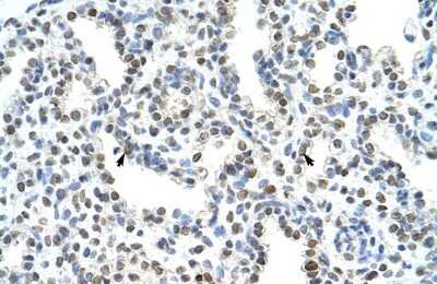 Immunohistochemistry: WDR6 Antibody [NBP1-54844]