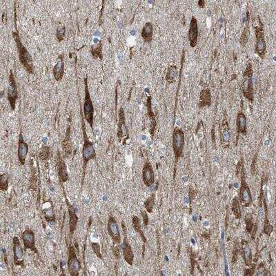 Immunohistochemistry: WDR60 Antibody [NBP1-90438]