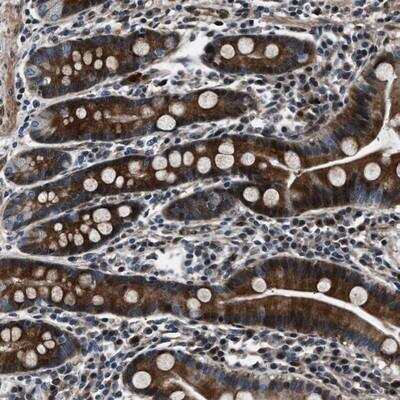 Immunohistochemistry-Paraffin: WDR60 Antibody [NBP1-90437]