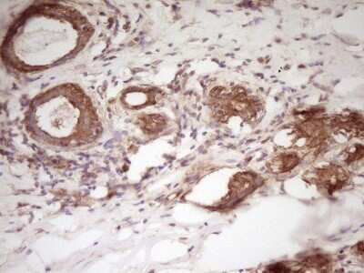 Immunohistochemistry: WDR61 Antibody (OTI4C4) [NBP2-46359]