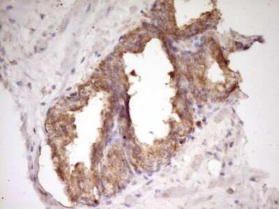 Immunohistochemistry: WDR61 Antibody (OTI4C4) [NBP2-46359]