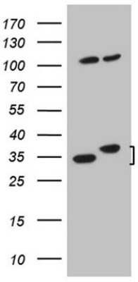 Western Blot: WDR61 Antibody (OTI4C4) [NBP2-46359]