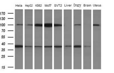 Western Blot: WDR61 Antibody (OTI4C4) [NBP2-46359]