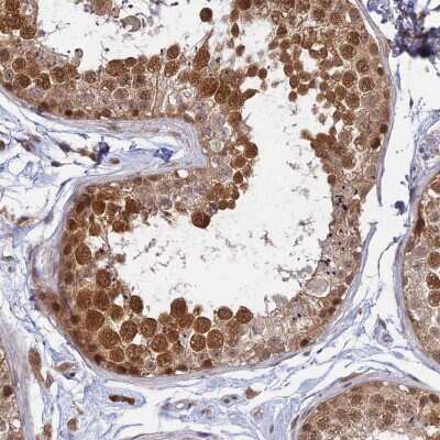 Immunohistochemistry-Paraffin: WDR61 Antibody [NBP1-80844]