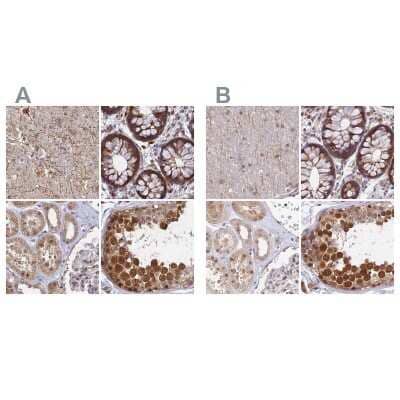 Immunohistochemistry-Paraffin: WDR61 Antibody [NBP1-80844]