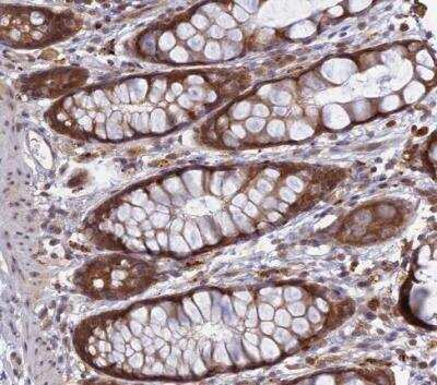 Immunohistochemistry-Paraffin: WDR61 Antibody [NBP1-80844]