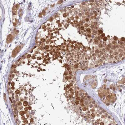 Immunohistochemistry-Paraffin: WDR61 Antibody [NBP1-80845]