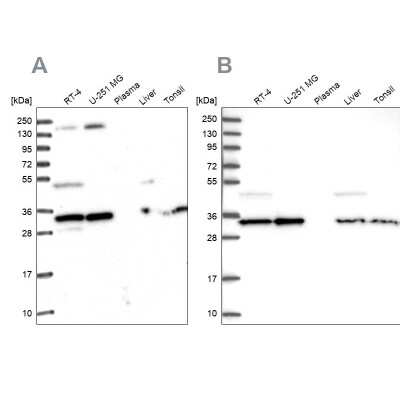 Western Blot: WDR61 Antibody [NBP1-80844]