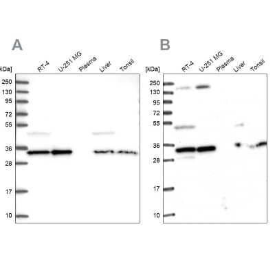 Western Blot: WDR61 Antibody [NBP1-80845]