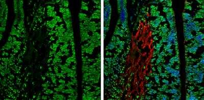 Immunocytochemistry/ Immunofluorescence: WDR62 Antibody [NBP2-20897]