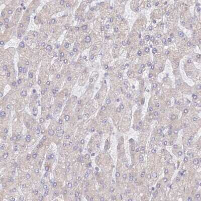 Immunohistochemistry-Paraffin: WDR62 Antibody [NBP2-47582]