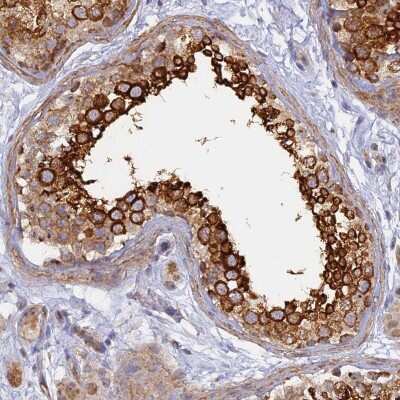 Immunohistochemistry-Paraffin: WDR62 Antibody [NBP2-47582]