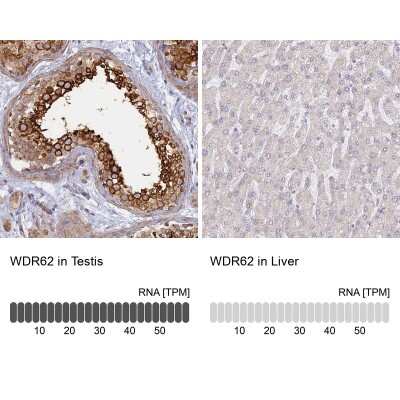 Immunohistochemistry-Paraffin: WDR62 Antibody [NBP2-47582]