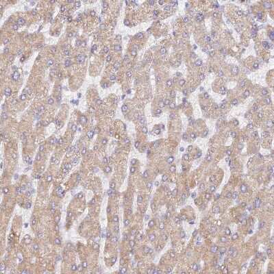 Immunohistochemistry-Paraffin: WDR62 Antibody [NBP2-48788]
