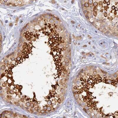 Immunohistochemistry-Paraffin: WDR62 Antibody [NBP2-48788]