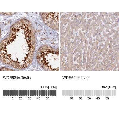 Immunohistochemistry-Paraffin: WDR62 Antibody [NBP2-48788]