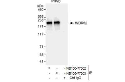 Immunoprecipitation: WDR62 Antibody [NB100-77302]