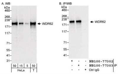 Western Blot: WDR62 Antibody [NB100-77303]