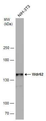 Western Blot: WDR62 Antibody [NBP2-20897]