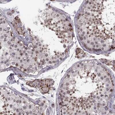 Immunohistochemistry-Paraffin: WDR63 Antibody [NBP2-32639]