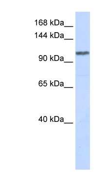 Western Blot: WDR63 Antibody [NBP1-56718]