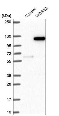 Western Blot: WDR63 Antibody [NBP2-32639]