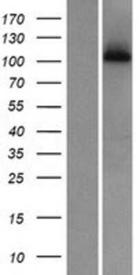 Western Blot: WDR63 Overexpression Lysate [NBP2-05500]