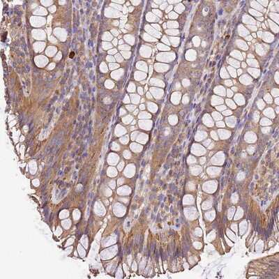 Immunohistochemistry-Paraffin: WDR64 Antibody [NBP1-93862]