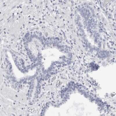 Immunohistochemistry-Paraffin: WDR65 Antibody [NBP1-82008]