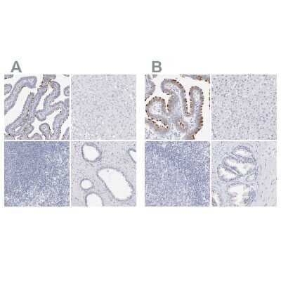 Immunohistochemistry-Paraffin: WDR65 Antibody [NBP1-82008]
