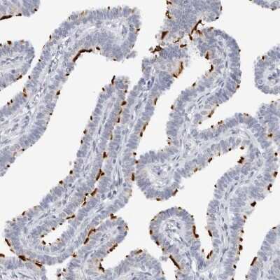 Immunohistochemistry-Paraffin: WDR65 Antibody [NBP1-82008]
