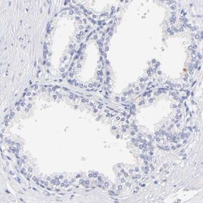 Immunohistochemistry-Paraffin: WDR65 Antibody [NBP1-82009]