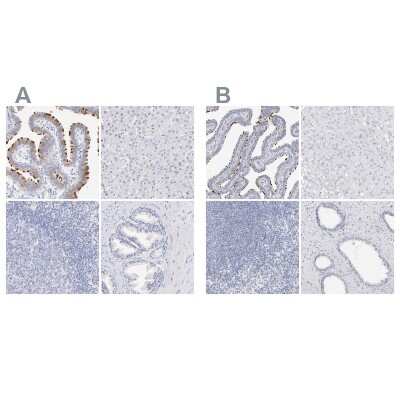 Immunohistochemistry-Paraffin: WDR65 Antibody [NBP1-82009]