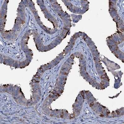 Immunohistochemistry-Paraffin: WDR66 Antibody [NBP1-82711]