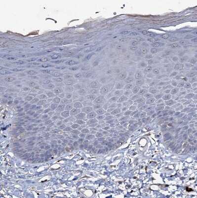 Immunohistochemistry-Paraffin: WDR66 Antibody [NBP1-82711]