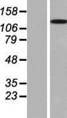 Western Blot: WDR66 Overexpression Lysate [NBP2-05543]