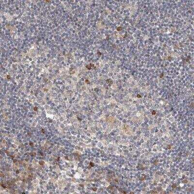 Immunohistochemistry: WDR67 Antibody [NBP1-81818]