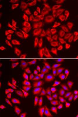 Immunocytochemistry/ Immunofluorescence: WDR68 Antibody - BSA Free [NBP3-03460]