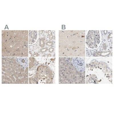 Immunohistochemistry-Paraffin: WDR68 Antibody [NBP1-92589]